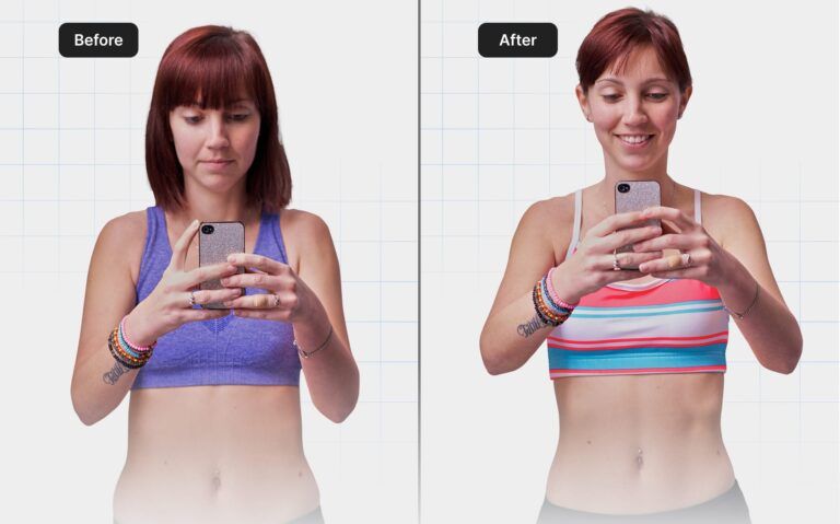 before-after-03.jpg