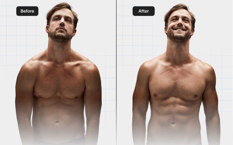before-after-05.jpg